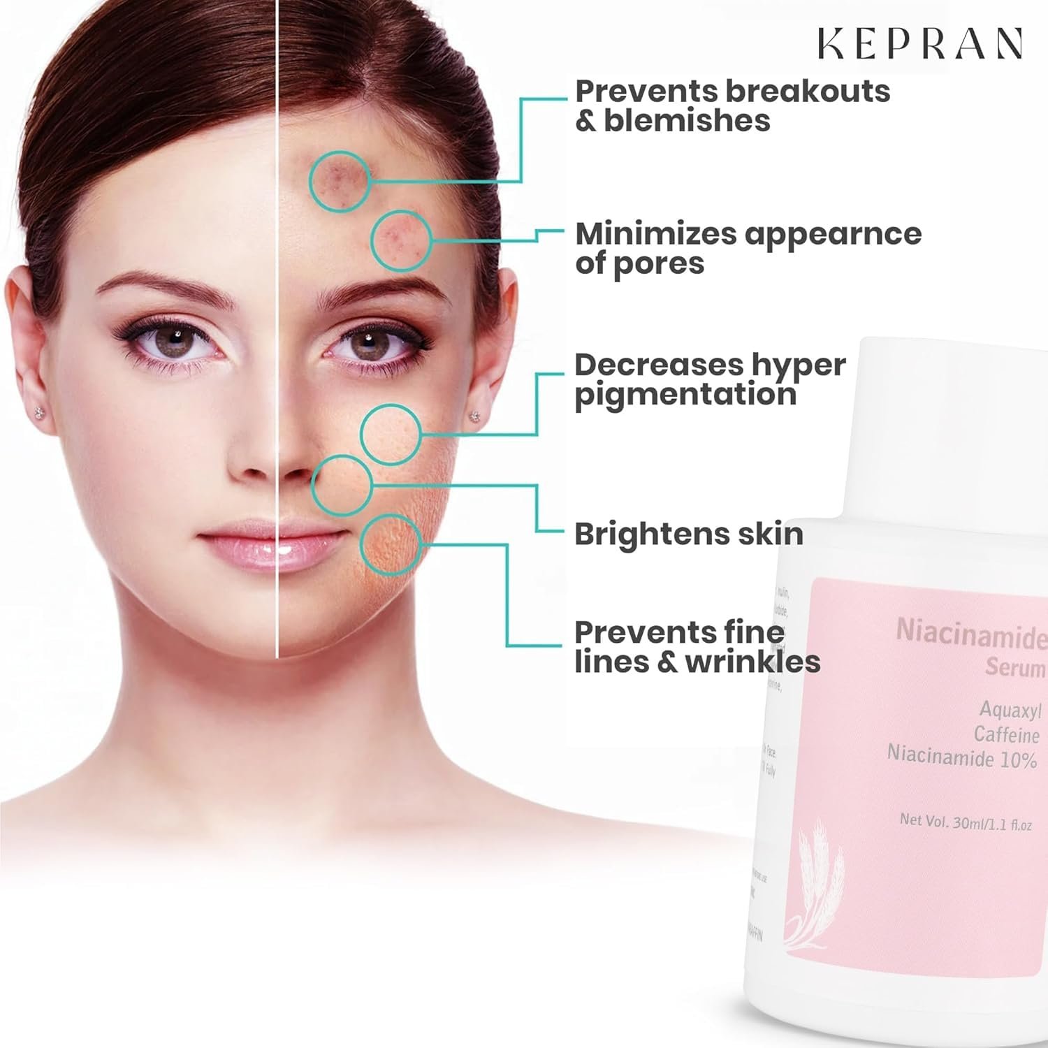 Niacinamide Serum with Aquaxyl and Caffeine, 10% niacinamide, 30ml